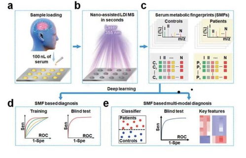 腦卒中快速診斷的革命性突破 中國(guó)學(xué)者引領(lǐng)的計(jì)算機(jī)輔助軟硬件研發(fā)新紀(jì)元